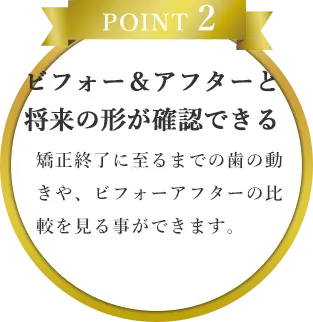POINT 2｜ビフォー＆アフターと
                    将来の形が確認できる｜矯正終了に至るまでの歯の動きや、ビフォーアフターの比較を見る事ができます。